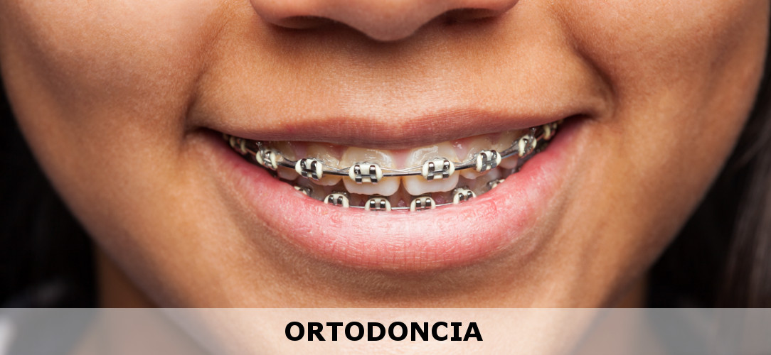 Persona con ortodoncia