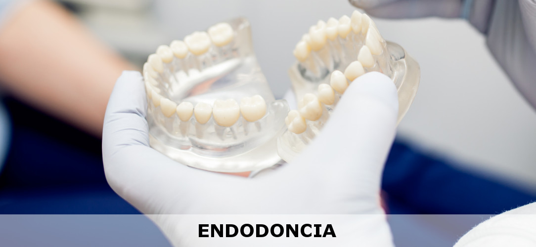 Endodoncia