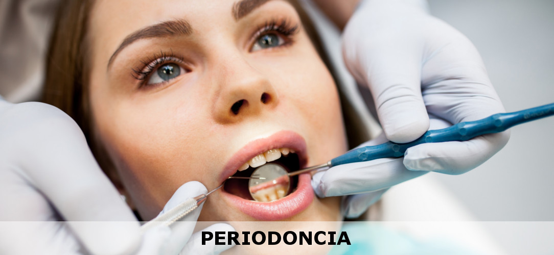 Periodoncia