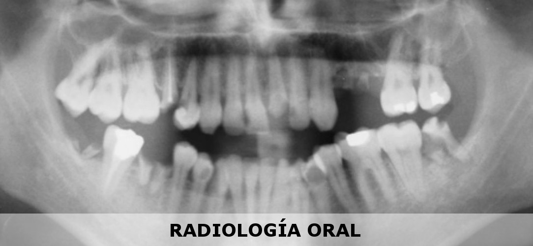 radiografía panorámica